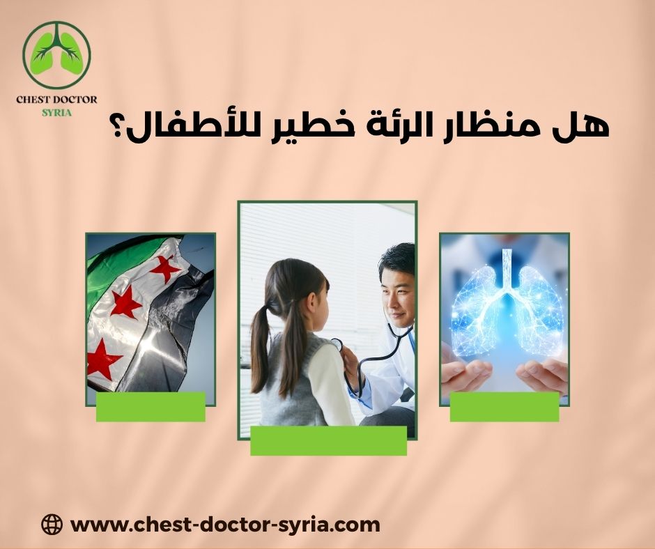 تنظير قصبات