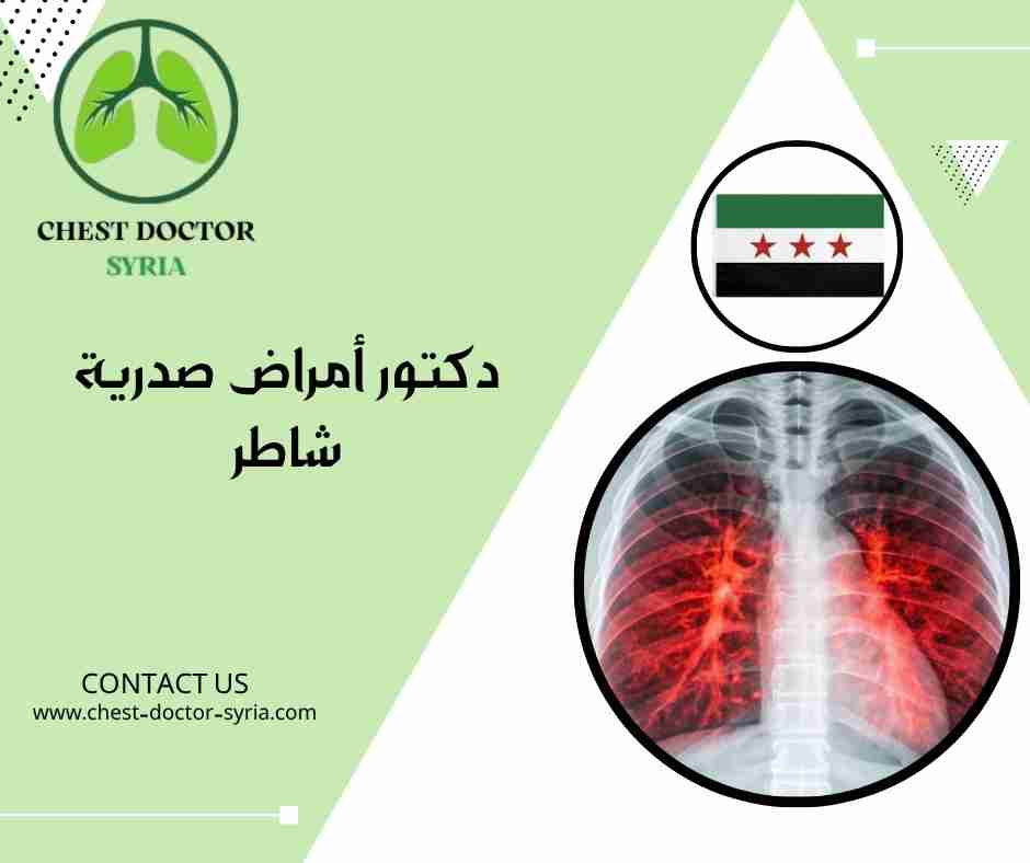 دكتور أمراض صدرية شاطر