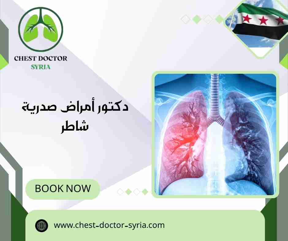 دكتور أمراض صدرية شاطر