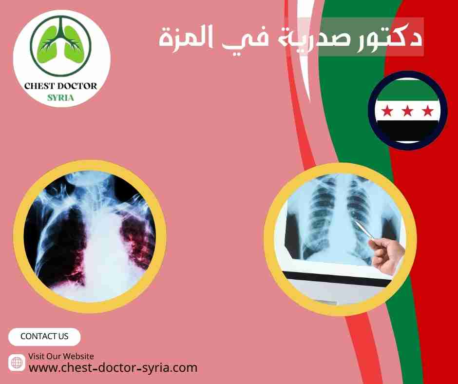 دكتور صدرية في المزة