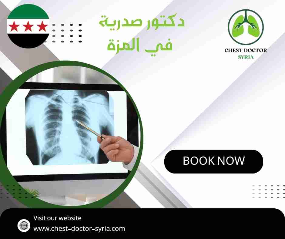 دكتور صدرية في المزة