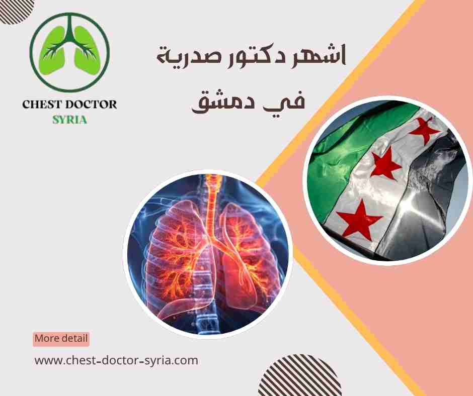 اشهر دكتور صدرية في دمشق