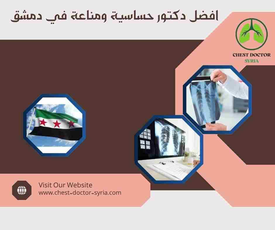 افضل دكتور حساسية ومناعة في دمشق