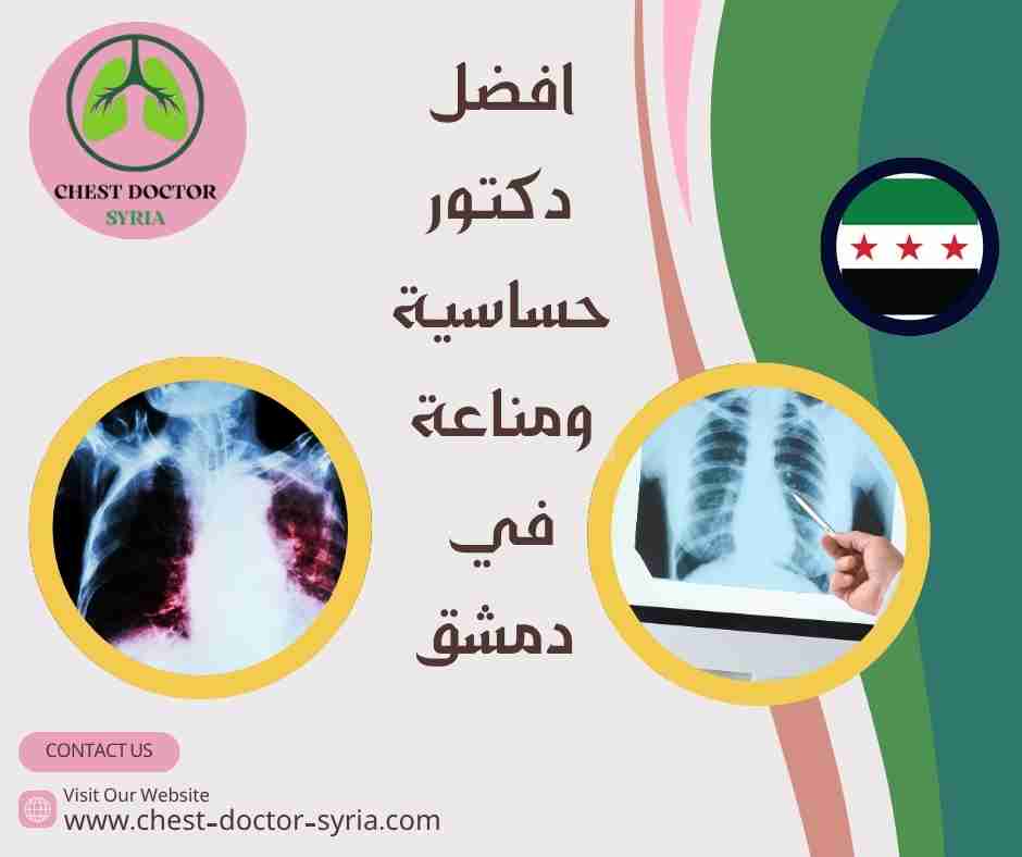 افضل دكتور حساسية ومناعة في دمشق