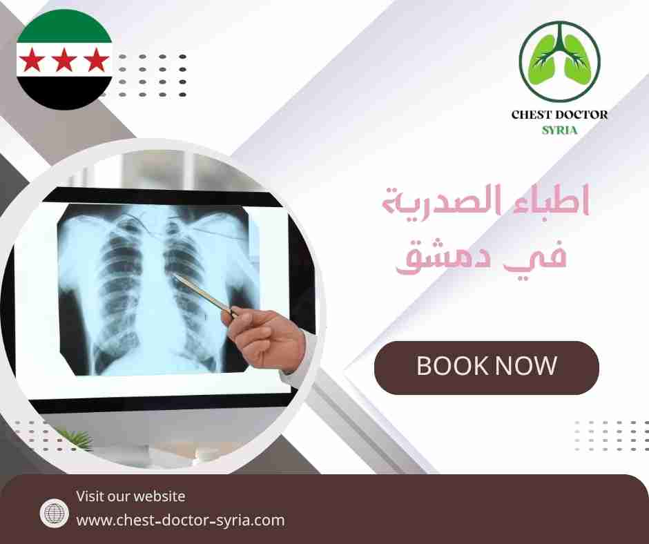 اطباء الصدرية في دمشق