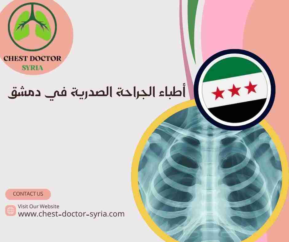 أطباء الجراحة الصدرية في دمشق
