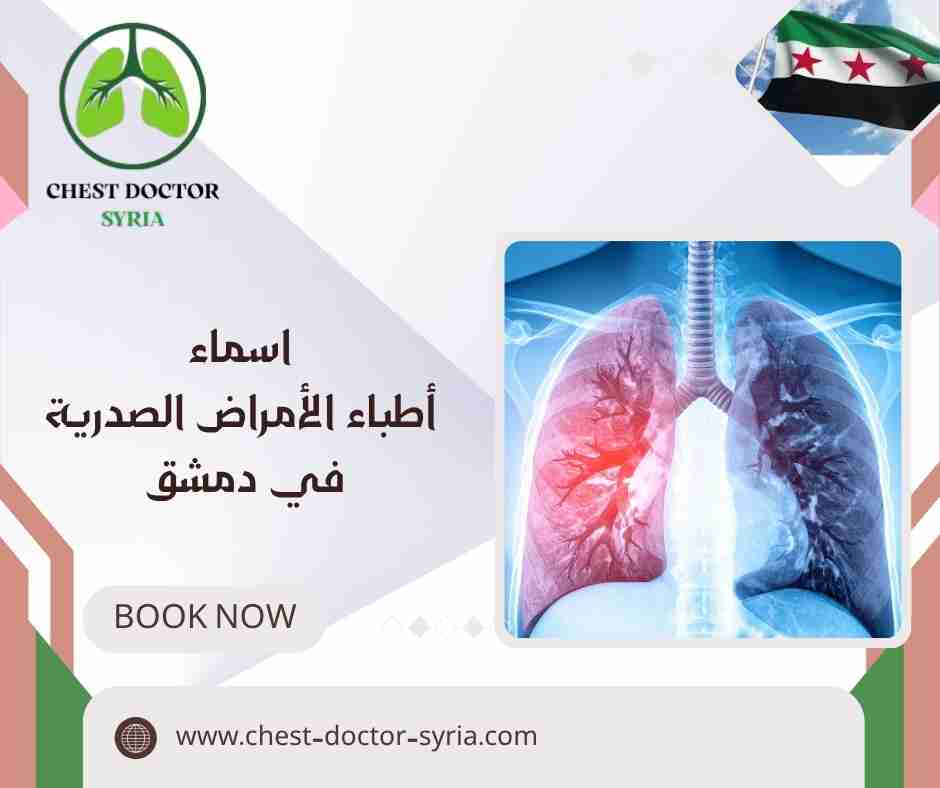 اسماء أطباء الأمراض الصدرية في دمشق