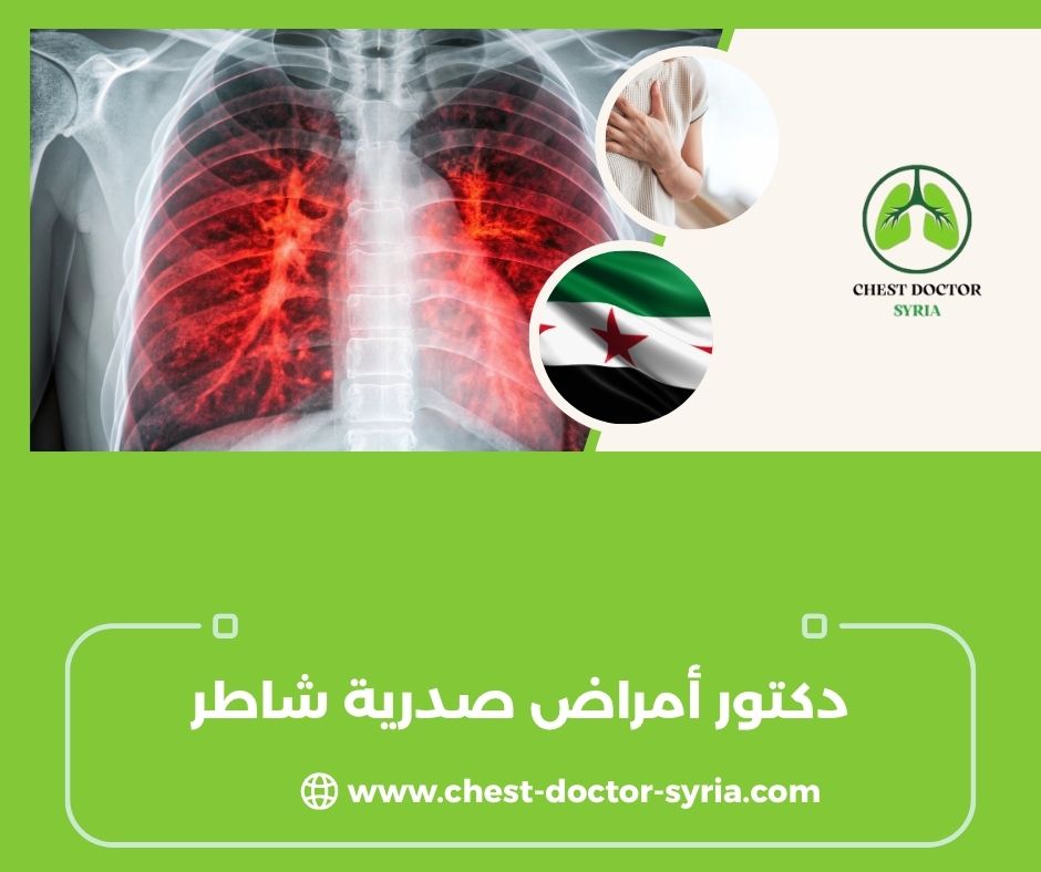 دكتور أمراض صدرية شاطر