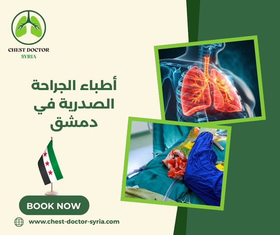 أطباء الجراحة الصدرية في دمشق