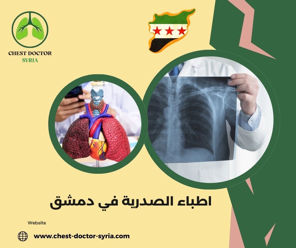 اطباء الصدرية في دمشق