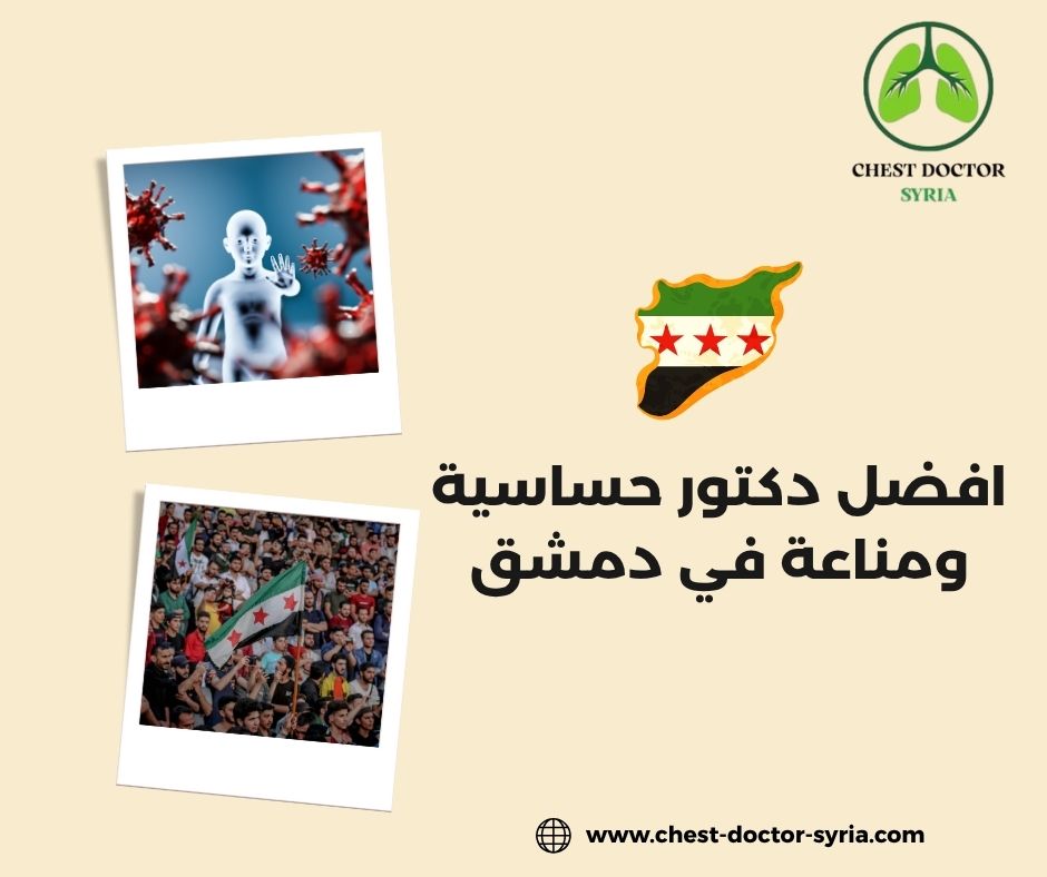 دكتور حساسية دمشق
