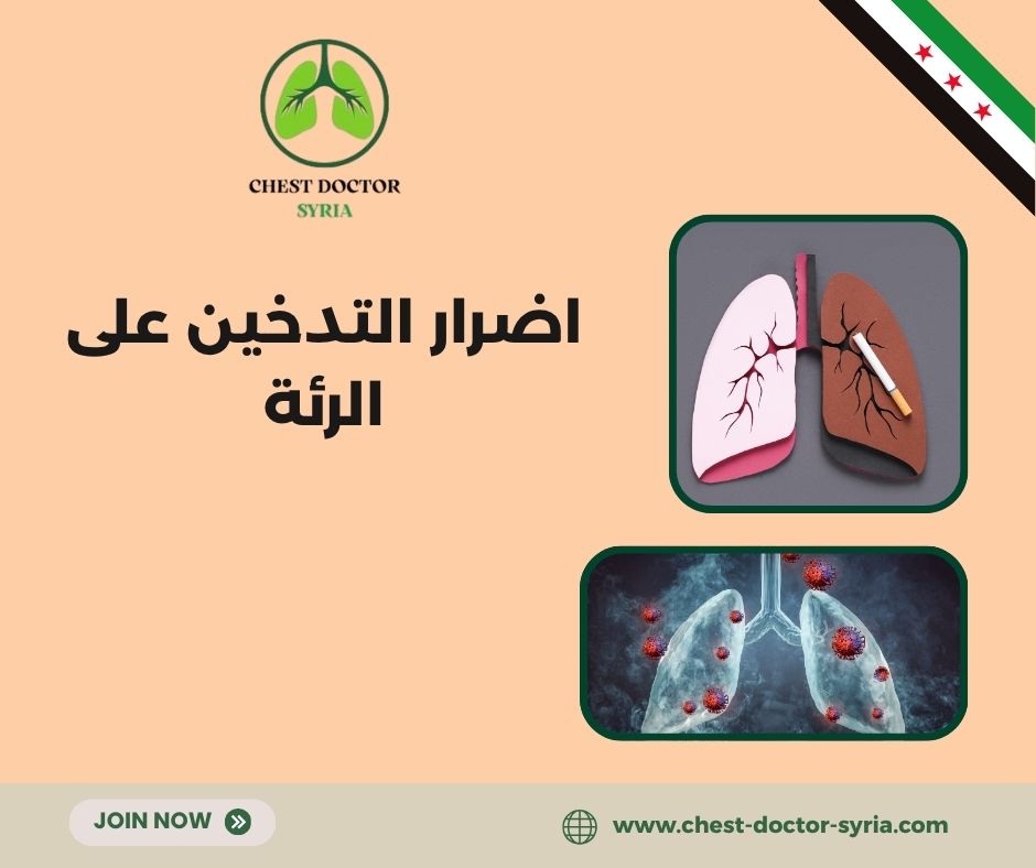 كيف تنظف رئتيك من سموم التدخين في3 أيام