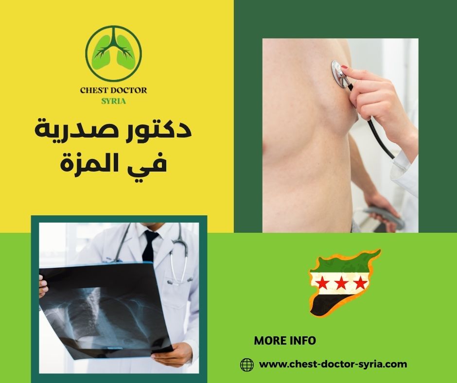 دكتور صدرية في المزة