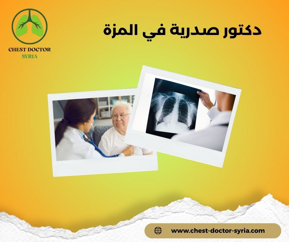 دكتور صدرية في المزة