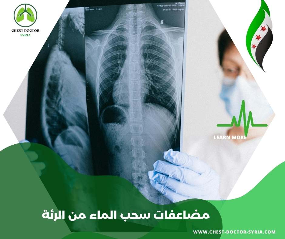 مضاعفات سحب الماء من الرئة