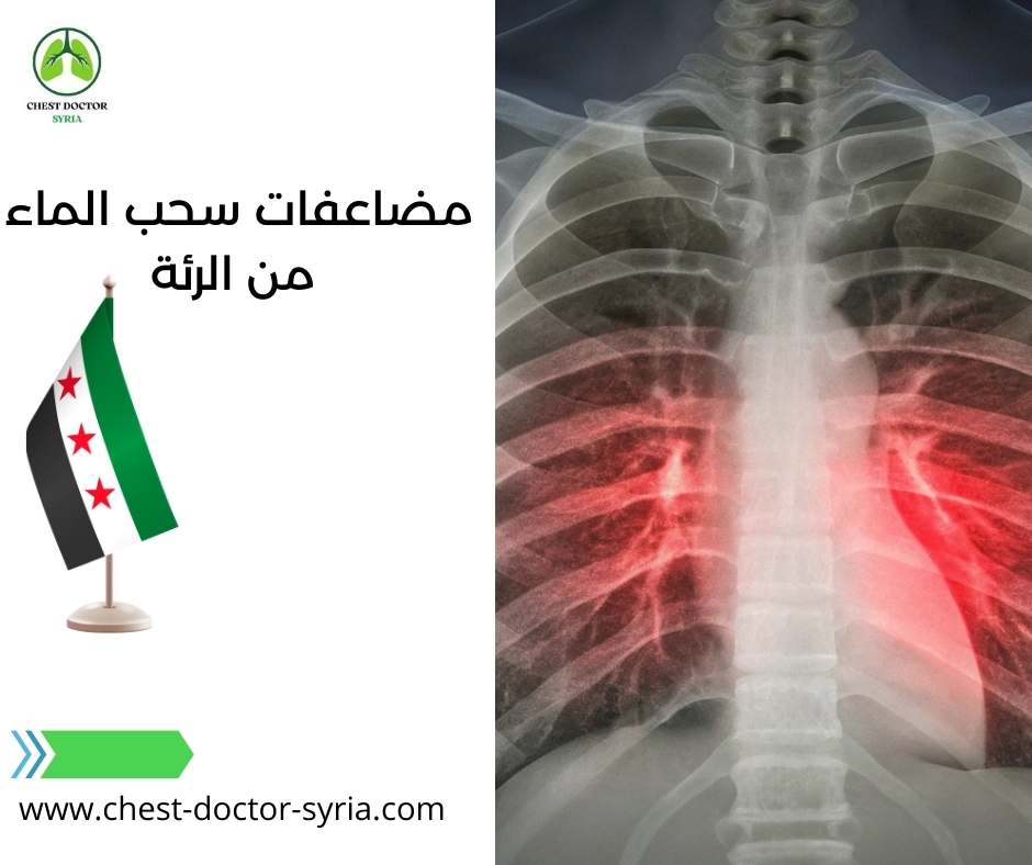 مضاعفات سحب الماء من الرئة