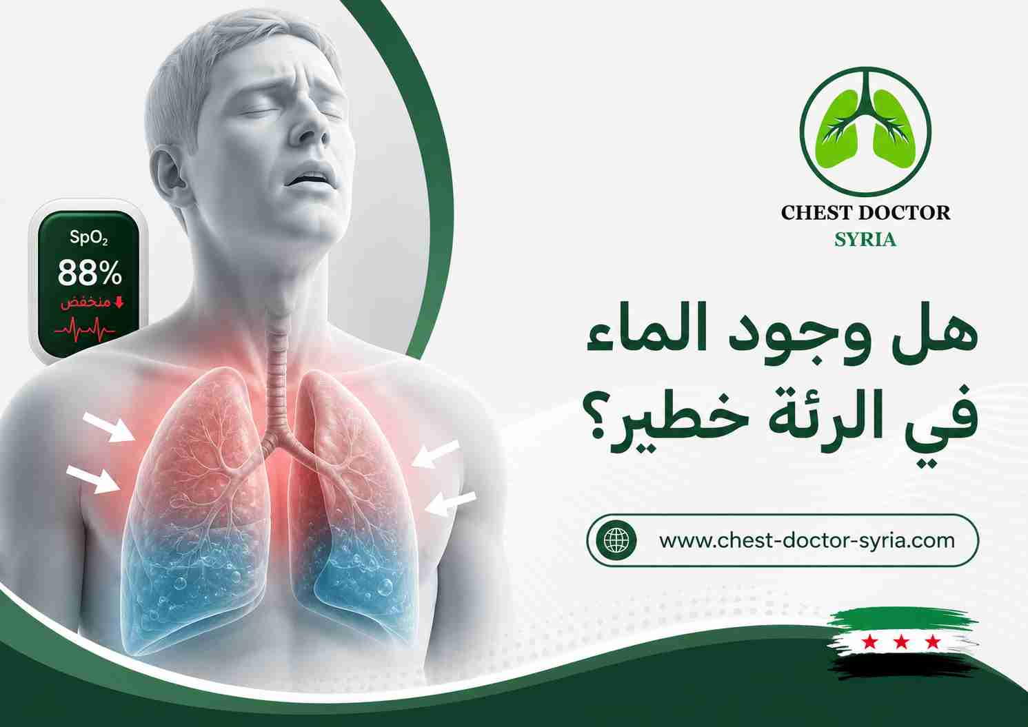 هل وجود الماء في الرئة خطير؟
