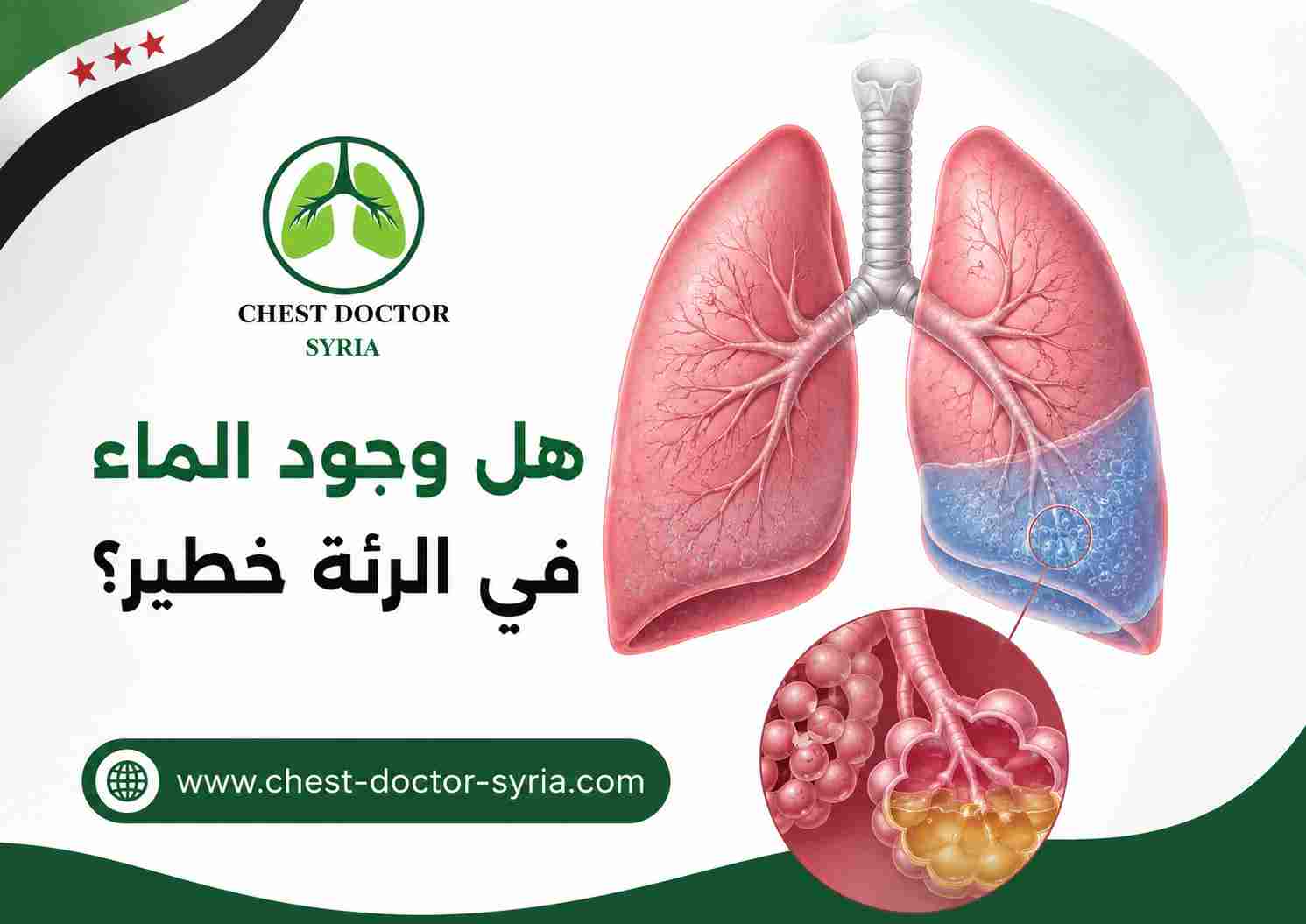 هل وجود الماء في الرئة خطير؟