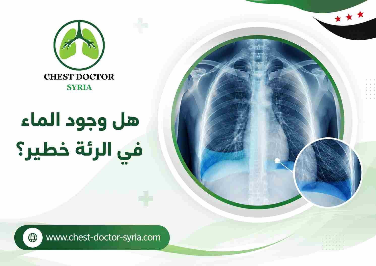 هل وجود الماء في الرئة خطير؟